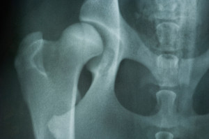 Hip Dysplasia in Poodles